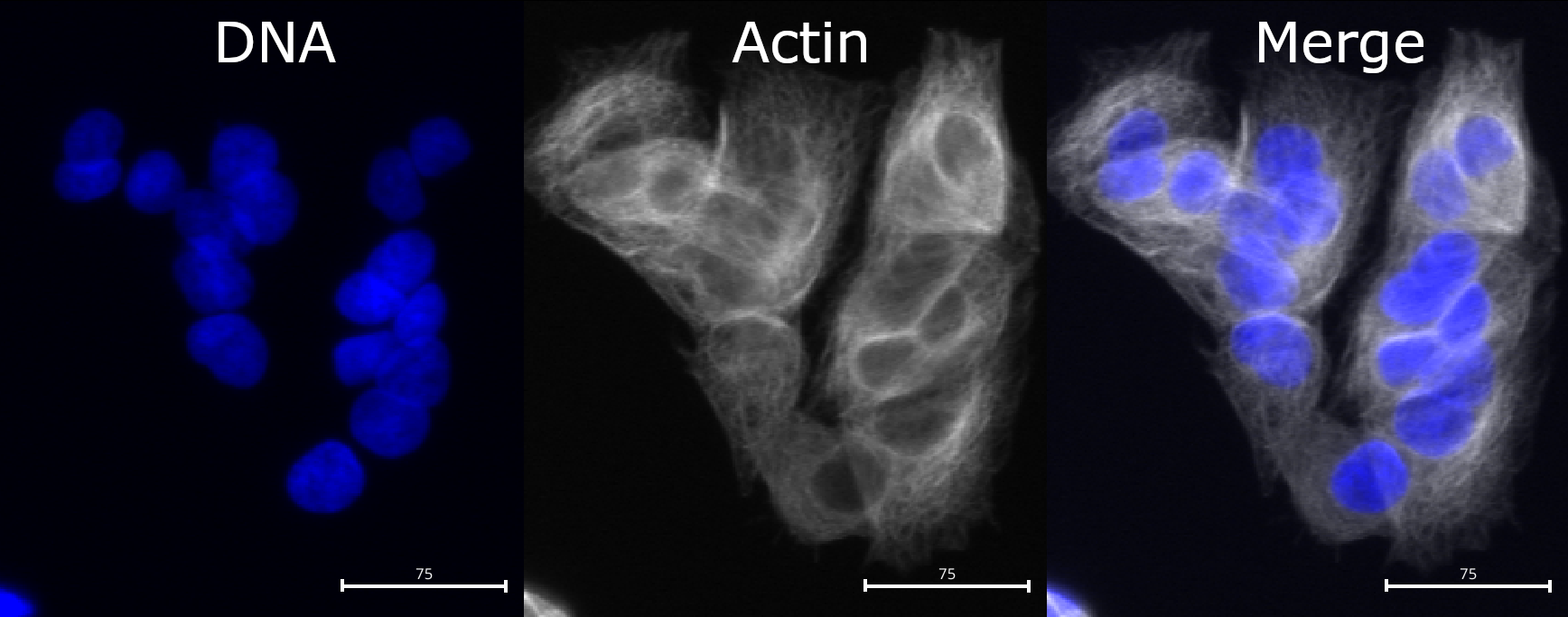 Picture of cells, with DNA stain shown in blue and actin stain shown in gray. While nuclei are fairly well separated, cell boundaries are touching in many places and are not easily distinguished.