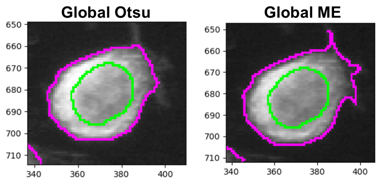 Side-by-side of Otsu and minimum cross-entropy thresholding results.